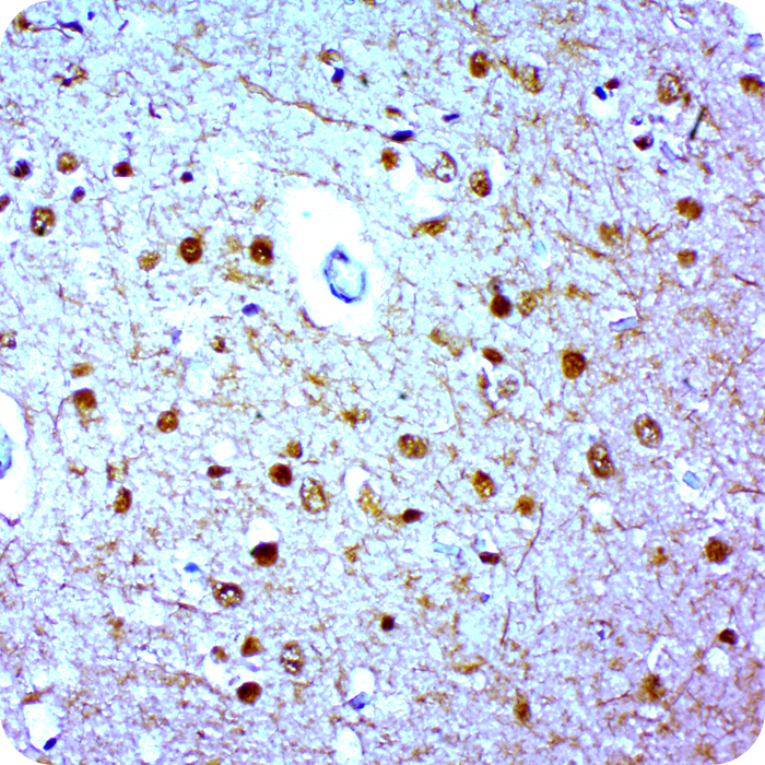 Neurofilament (H&L); Clone 2F11 (Ready-To-Use)